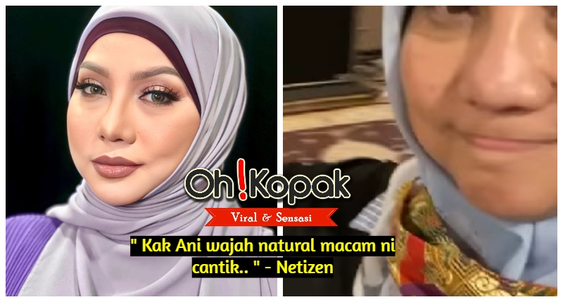 Kak Ani wajah natural macam ni cantik.. ” - Netizen | Oh! Kopak